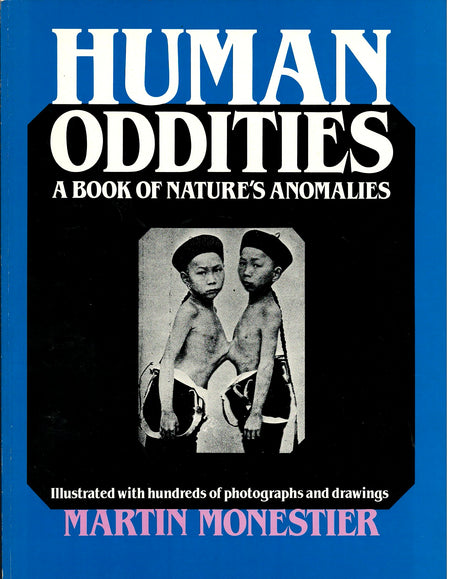 Human Oddities: A Book of Nature's Anomalies by Martin Monestier